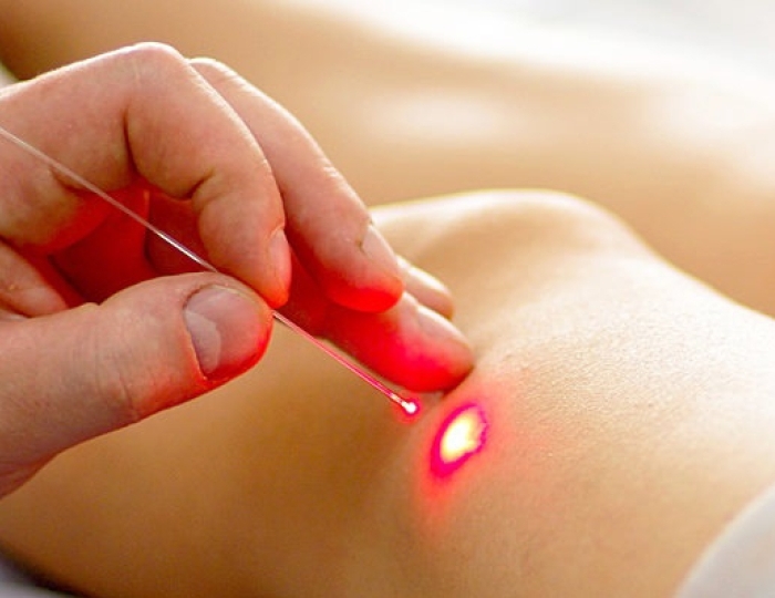 Светолечение - Санаторий «Пикет» Кисловодск